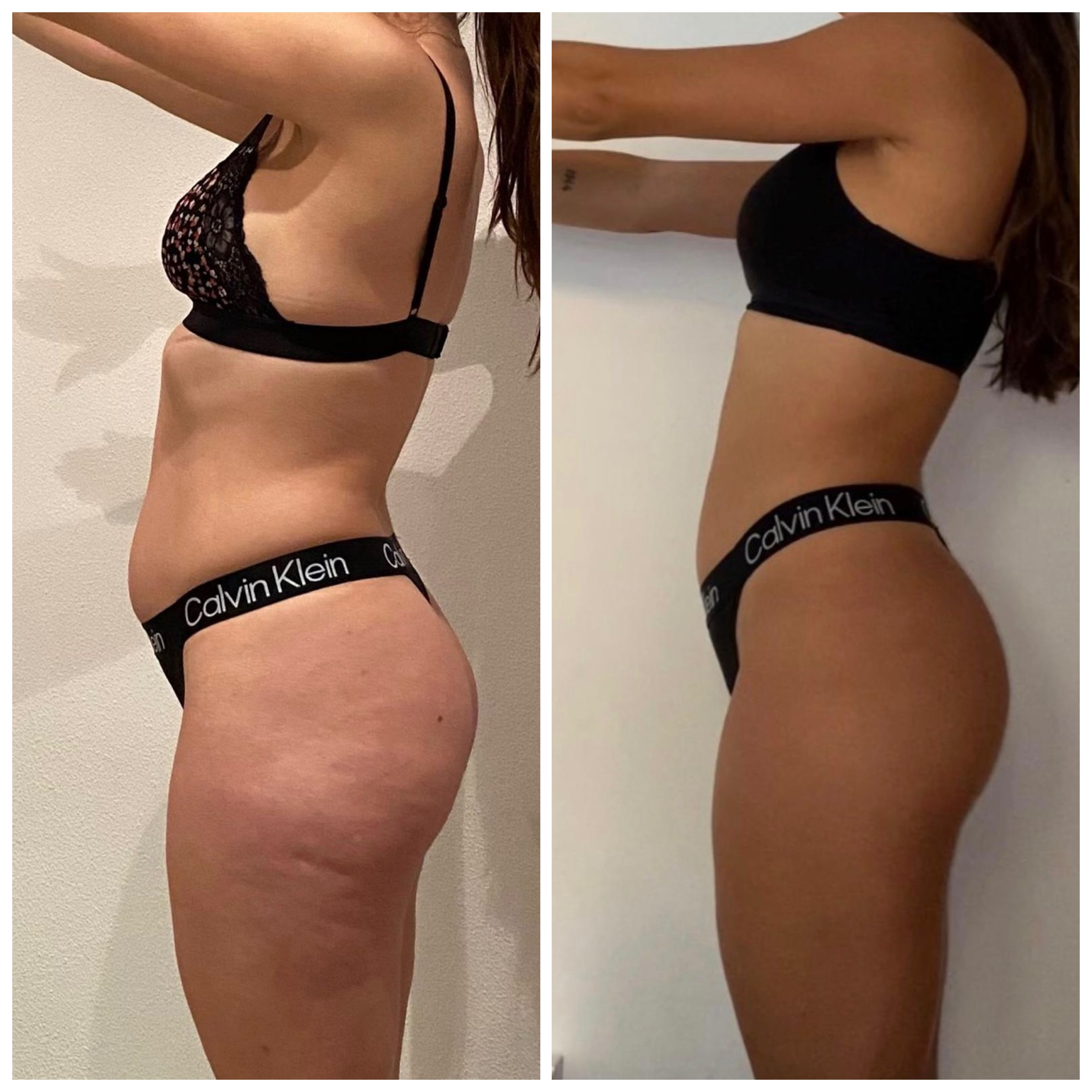 Transformación física