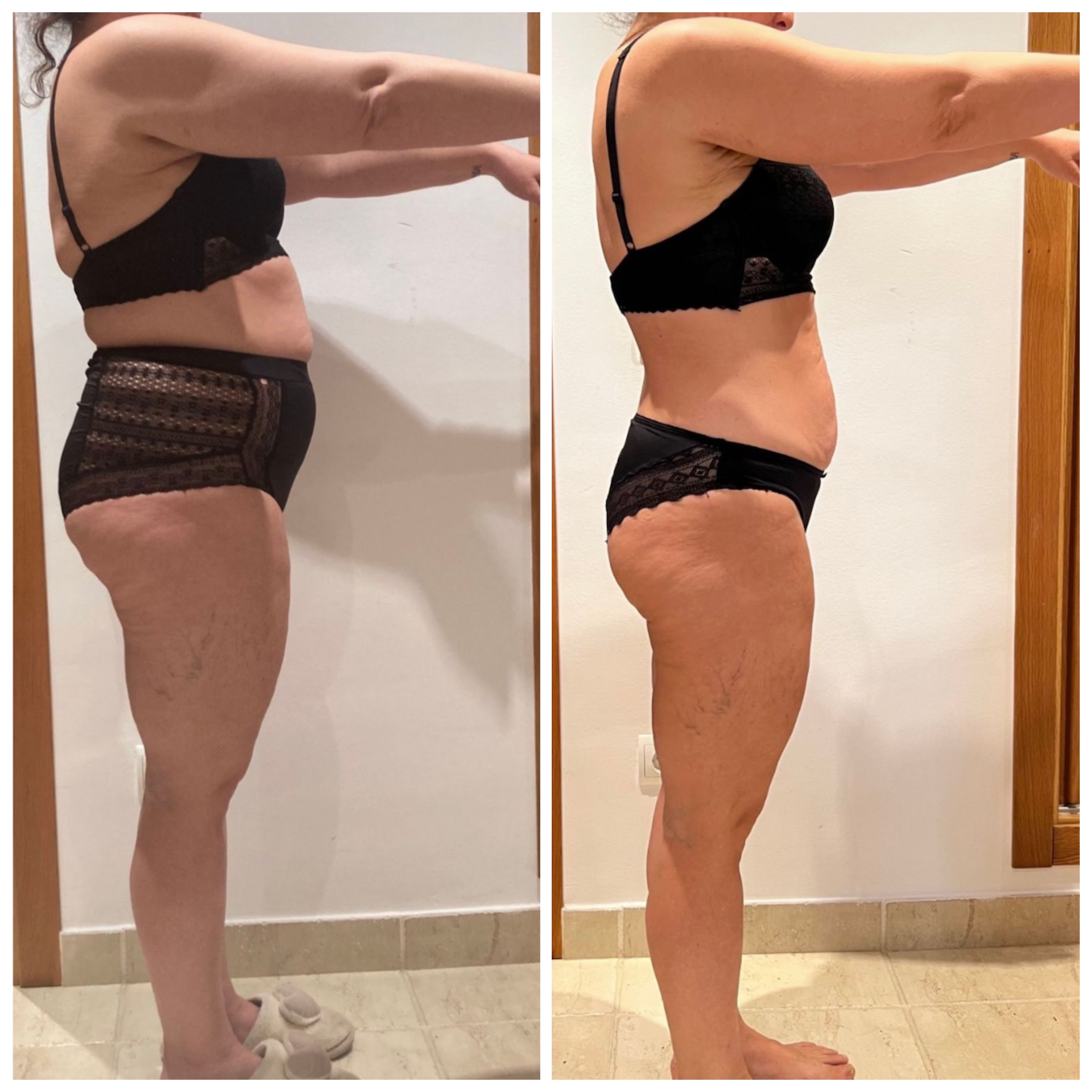 Transformación física