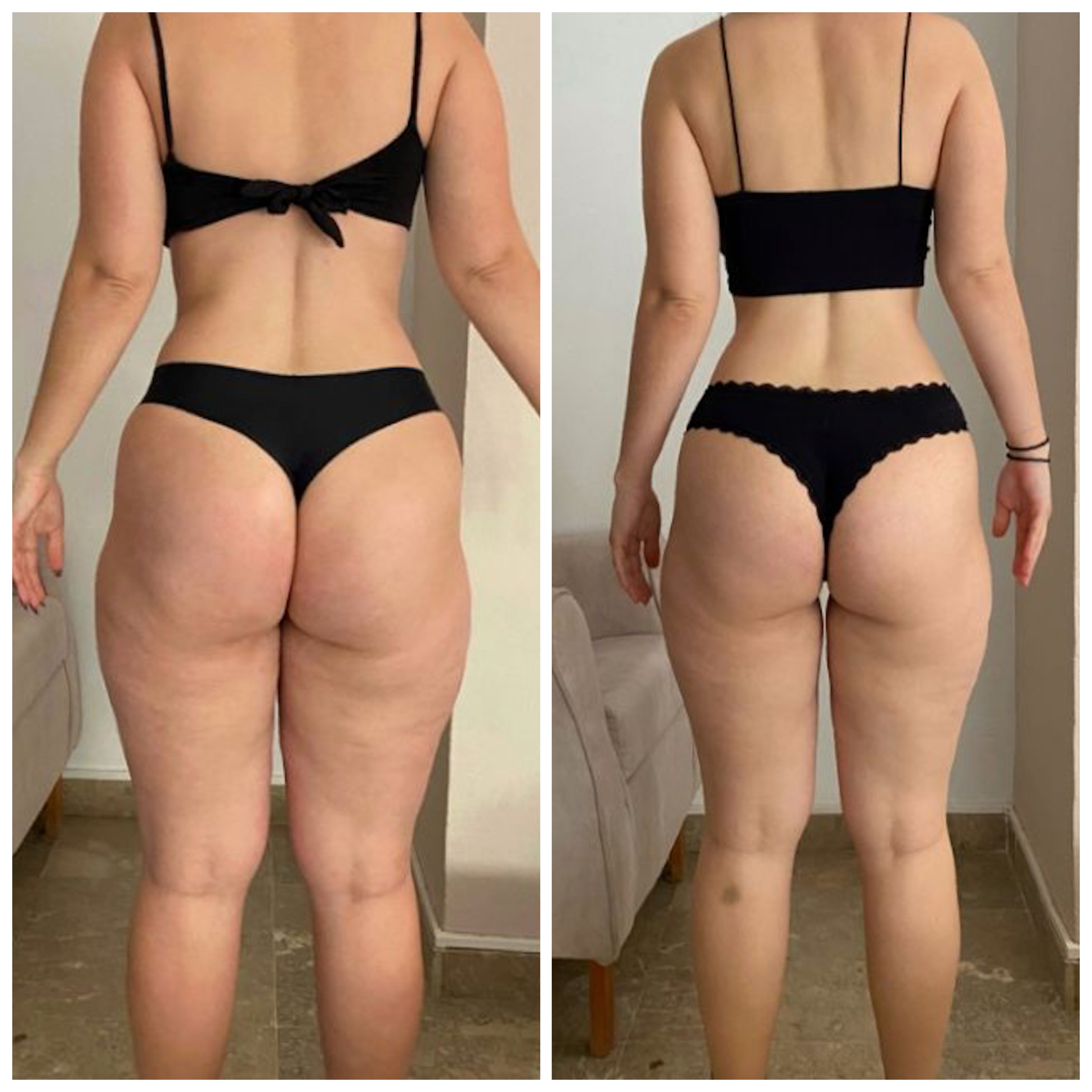 Transformación física